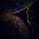 Laser Scanning Confocal Microscopy