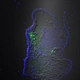 Laser Scanning Confocal Microscopy